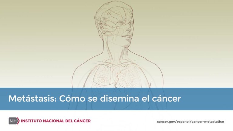 Descubre el impacto del c&aacute;ncer galopante: una amenaza creciente